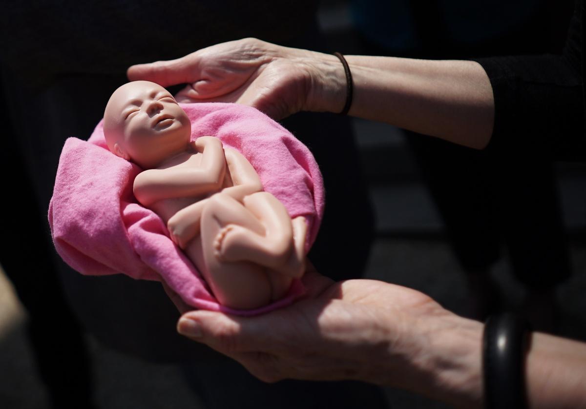 Confronting the Medical Debate Around After-Birth Abortion