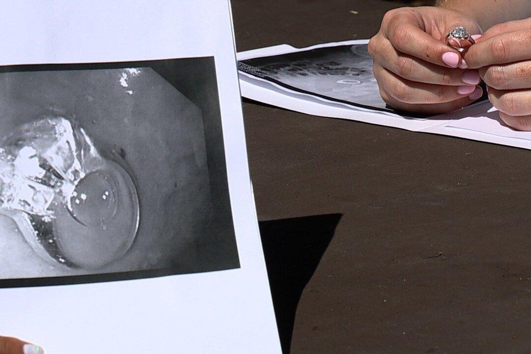 Woman Eats Engagement Ring After Having a Dream About It