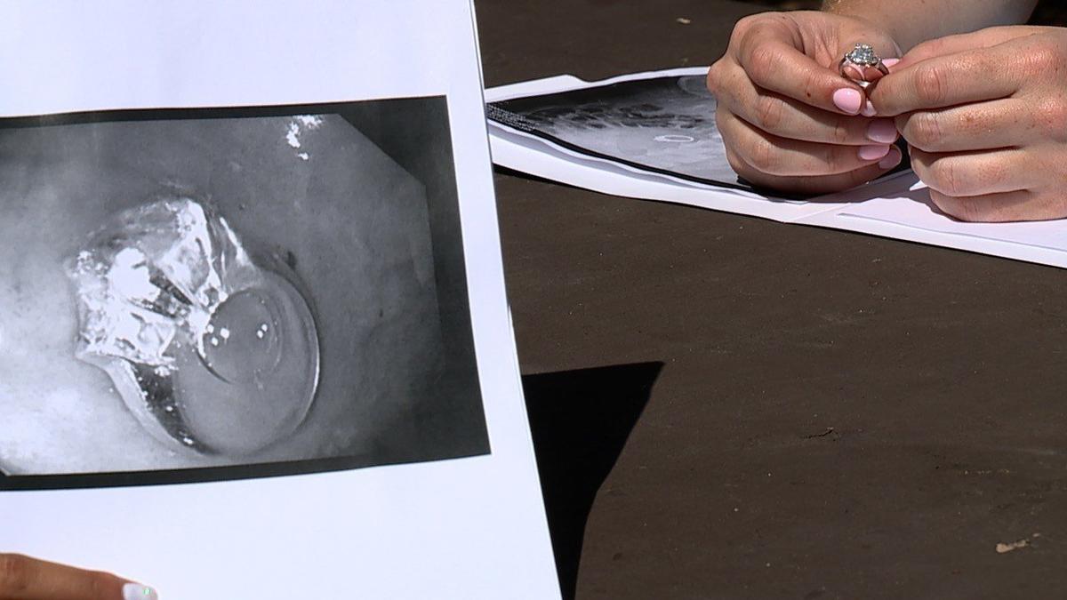 Woman Eats Engagement Ring After Having a Dream About It