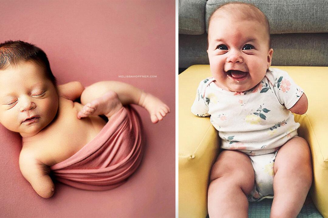 Mother’s Unborn Baby Had No Hands, and Doctors Suggested Terminating–She Refused