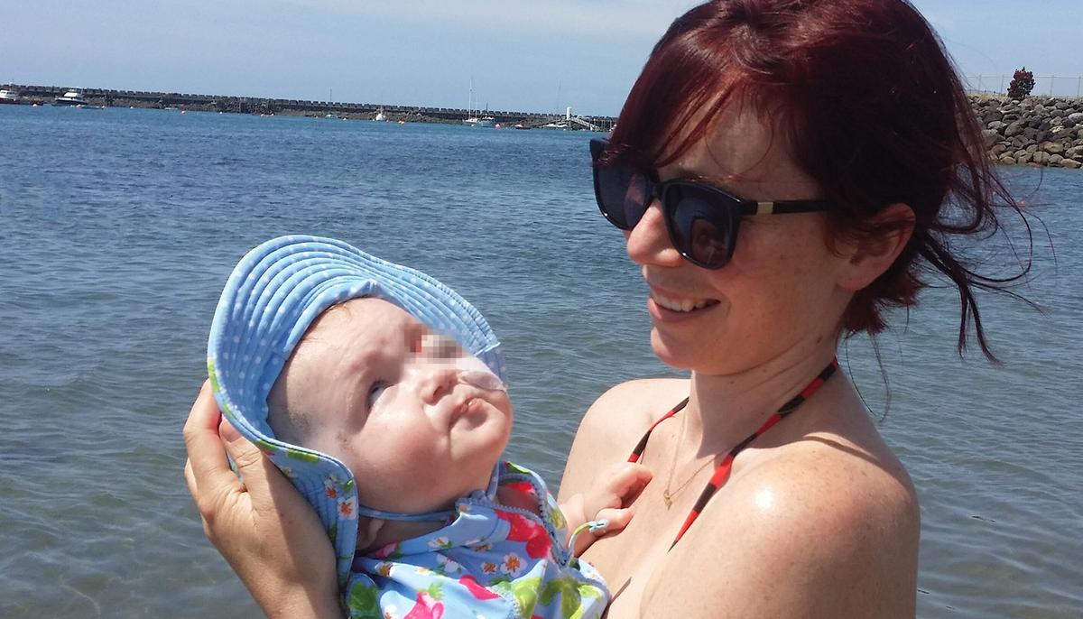 ‘The One-in-a-Million Baby’: Mom’s Story of Parenting a Child With Complex Disabilities