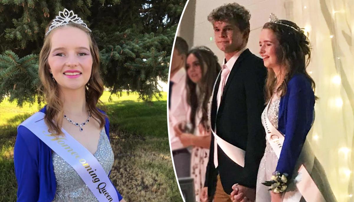 17-Year-Old Crowned Homecoming Queen After Surviving Being Shot in the Head