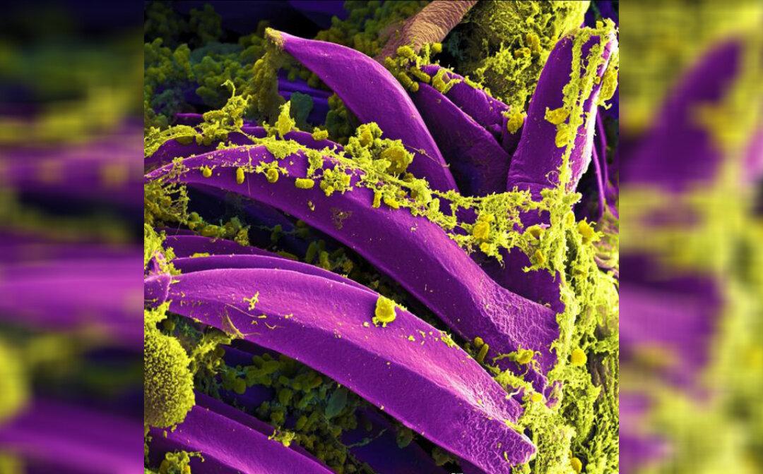 Two People Diagnosed With Pneumonic Plague in China