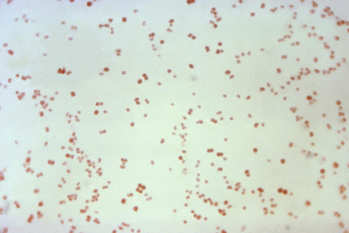 Infections From Antibiotic Resistant ‘Superbugs’ on the Rise, New CDC Report Says