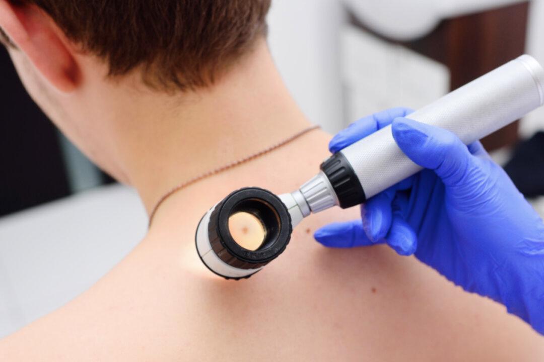 Key Markers Identify Which Melanoma Patients Respond Best to ICI Therapy