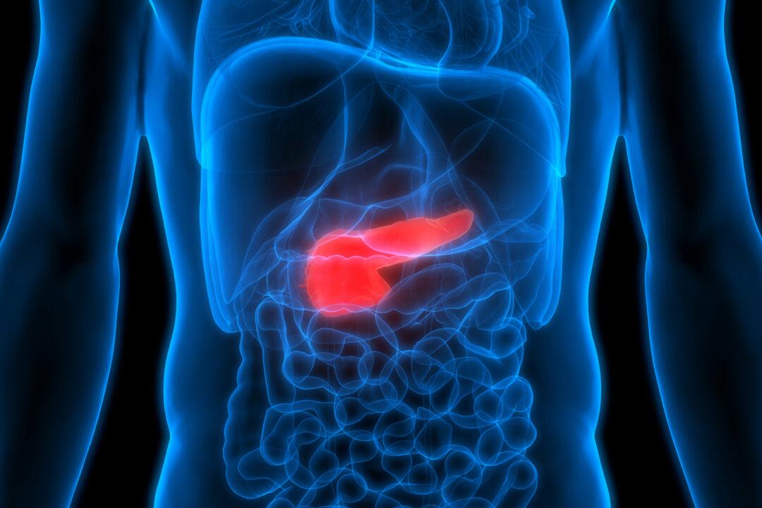 Why Is Pancreatic Cancer the Deadliest Cancer? Is There a Way to Prevent It?
