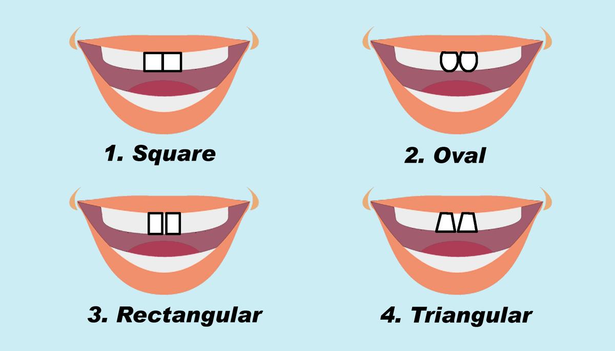 The Shape of Your Two Front Teeth Can Tell About Your Personality–Rectangular Teeth Predict Leadership