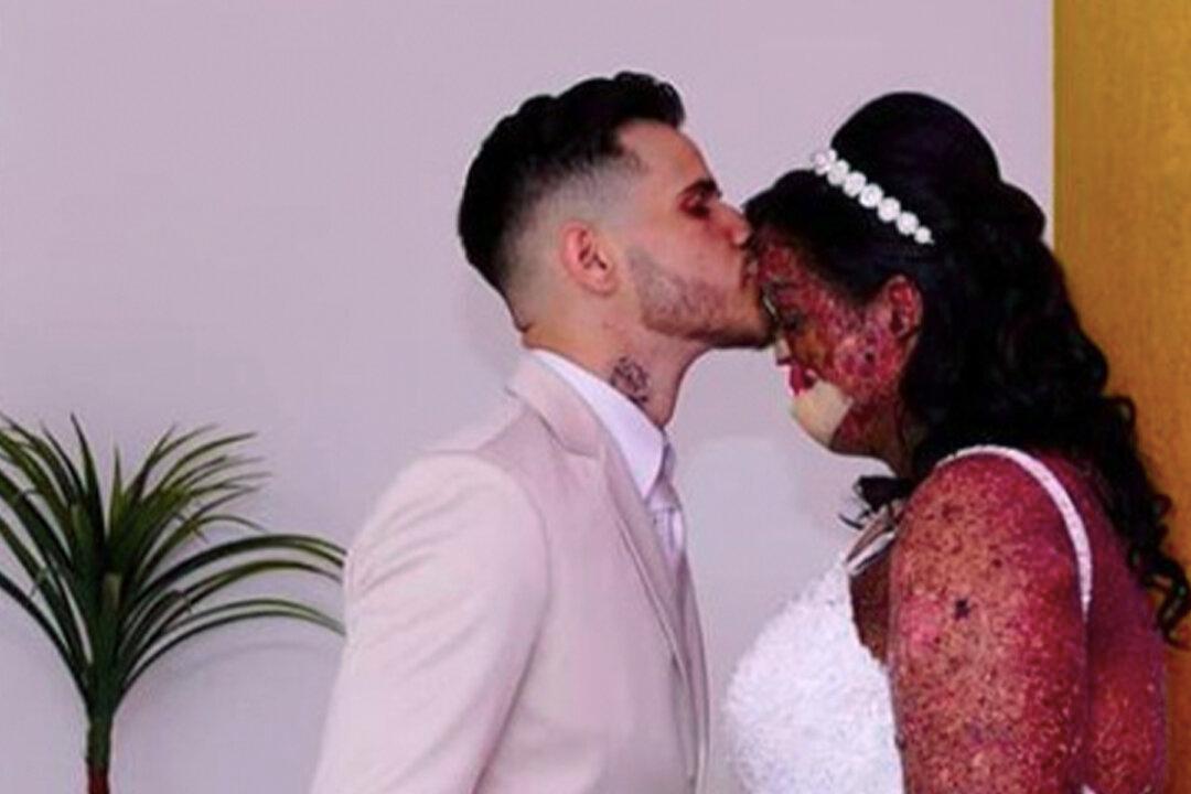 Woman With Rare Skin Disease Finds True Soulmate: ‘Love Exists, Believe Me!’