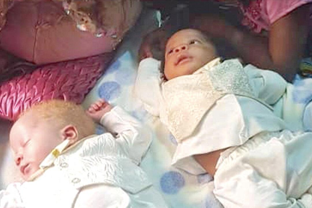 Mom Gives Birth to Rare Twins With Different Skin Colors, One Black and One White