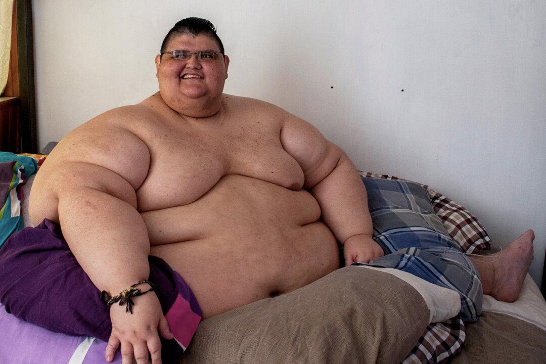 ‘World’s Fattest Man’ Loses 728 Pounds, Leaves Bed, Walks on Own 2 Feet for the First Time in 10 Years