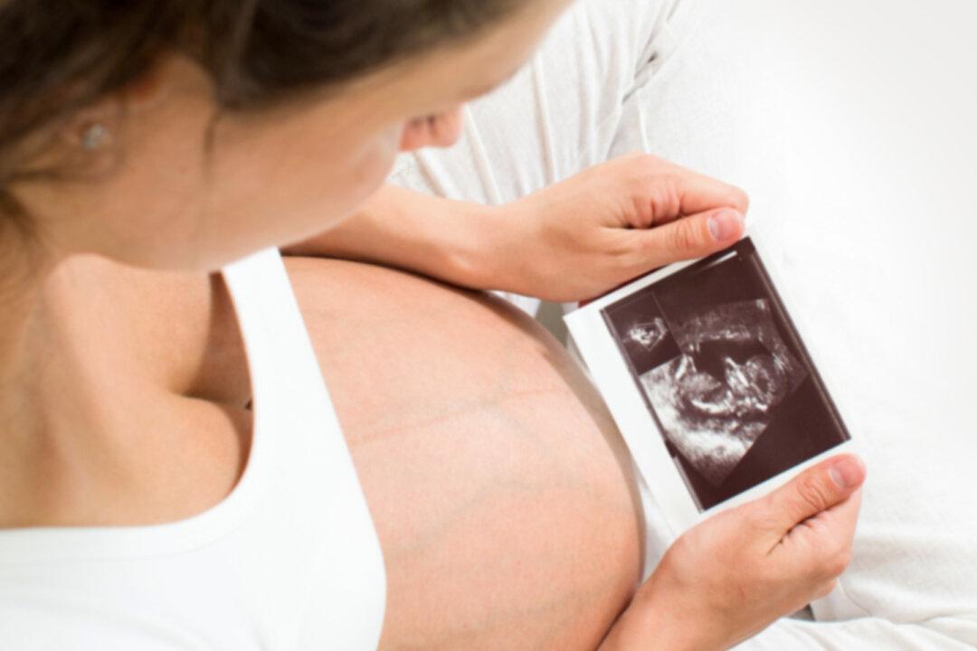 Young Mom’s Ultrasound Pic Reveals Late Father Kissing Unborn Daughter, She Says