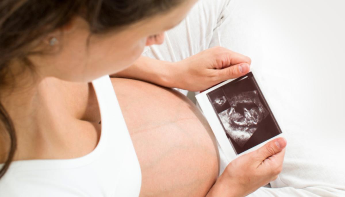 Young Mom’s Ultrasound Pic Reveals Late Father Kissing Unborn Daughter, She Says