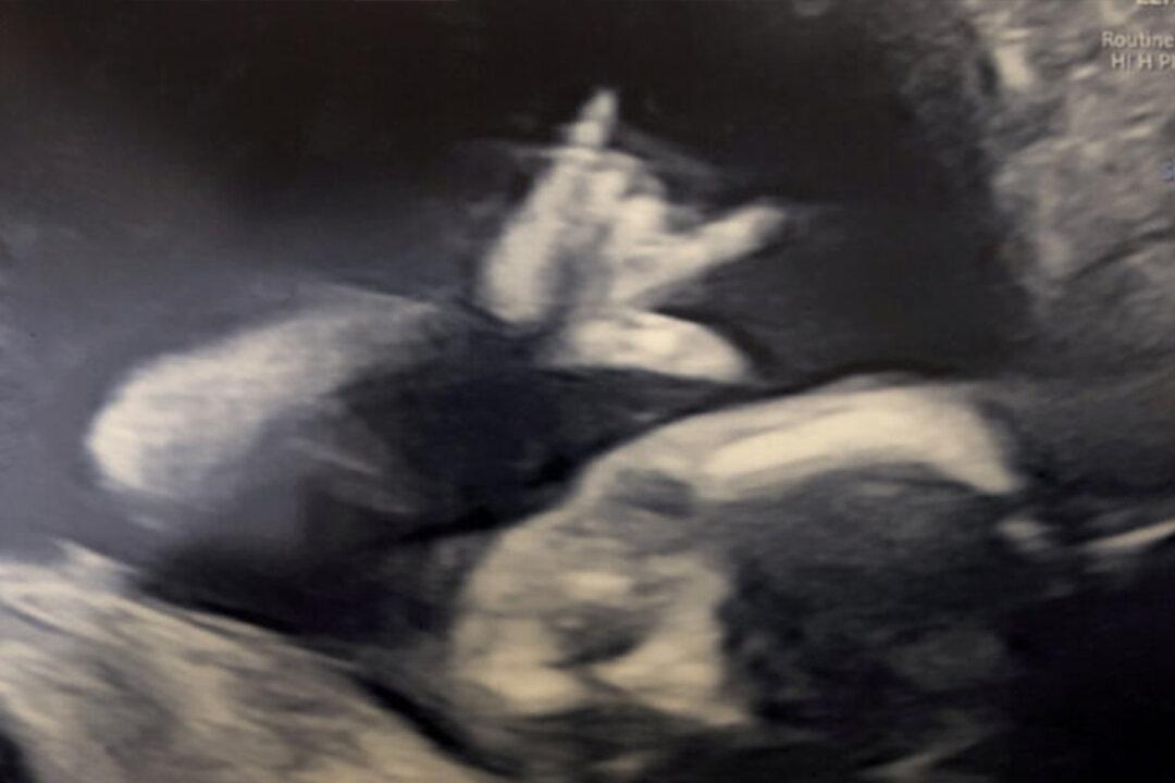 Unborn Baby Surprises Parents With a Heavy-Metal Rock Sign During Week-19 Ultrasound