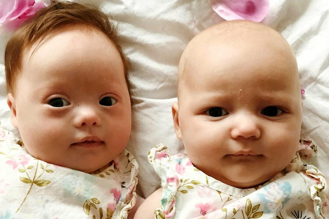 ‘One-in-a-Million’ Twins: One Born With Down Syndrome, and the Other Without