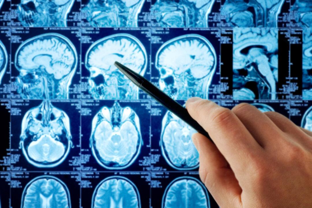 Parents Make Epic Bucket List for Son, 4, Whose ‘Crooked Smile’ Turned Out to Be Fatal Brain Cancer