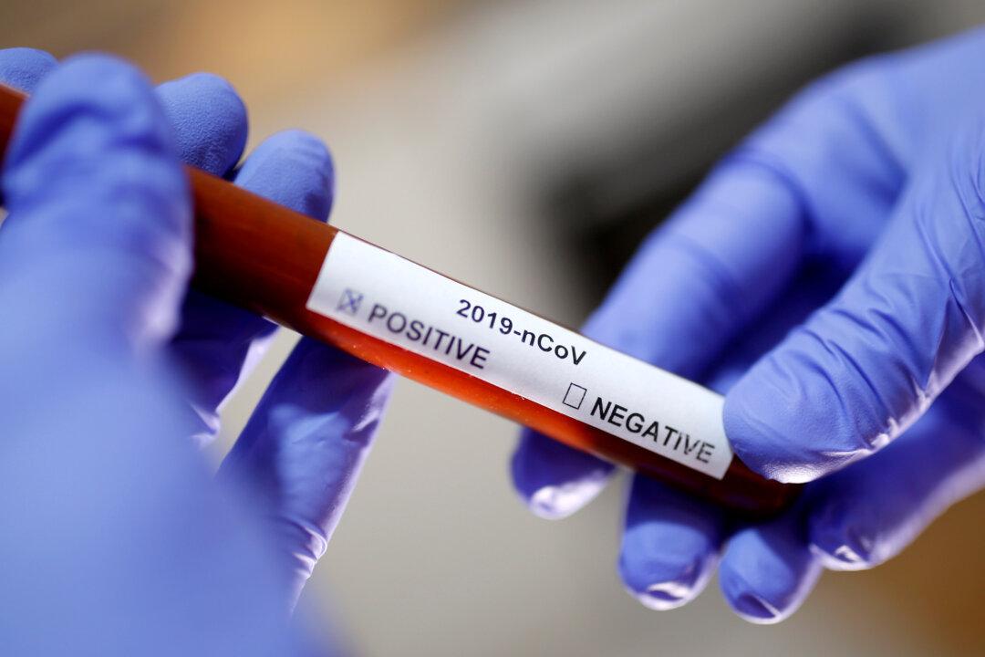 Labs in All 50 States Testing for New Coronavirus