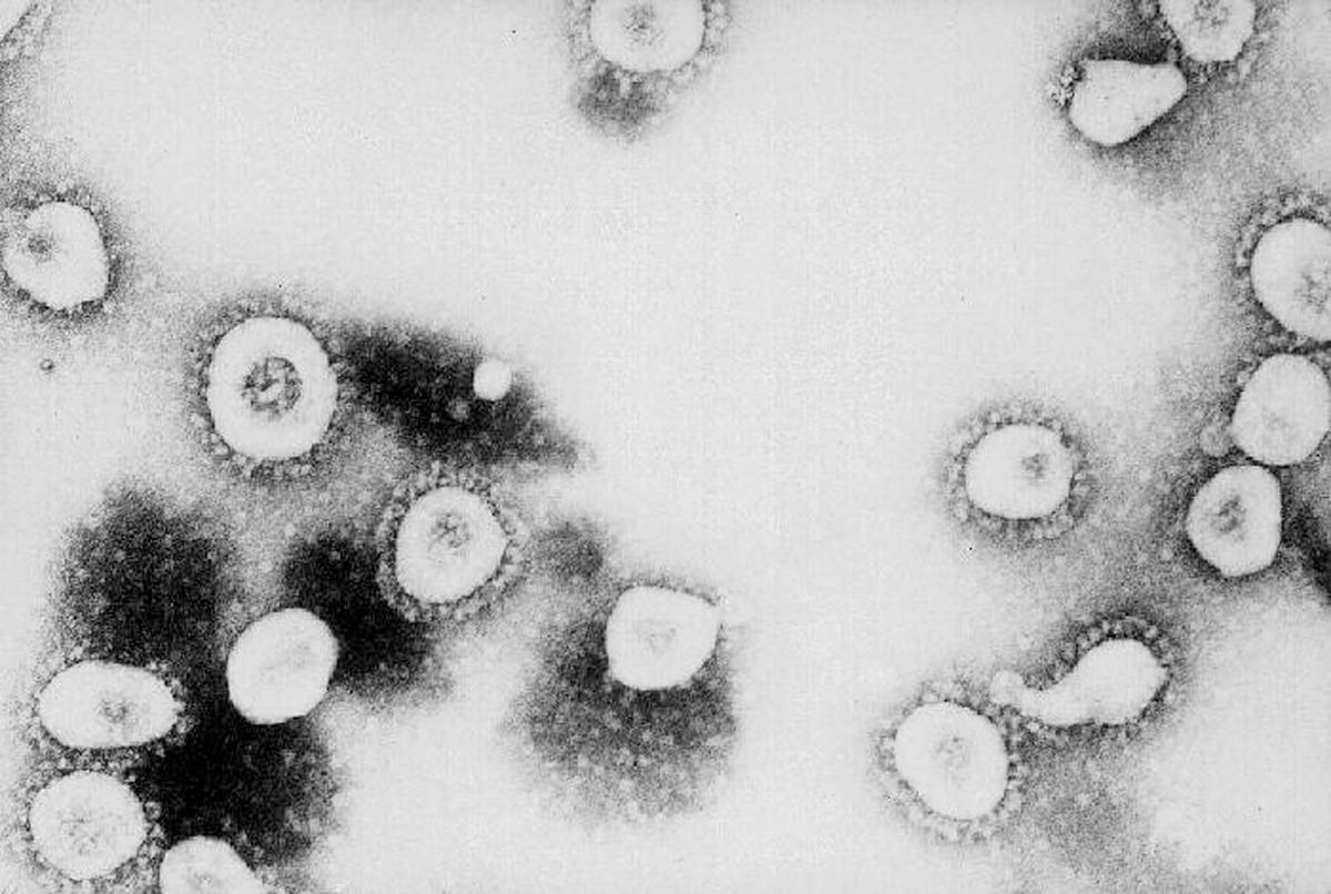Iowa Confirms First 3 Presumptive Coronavirus Cases