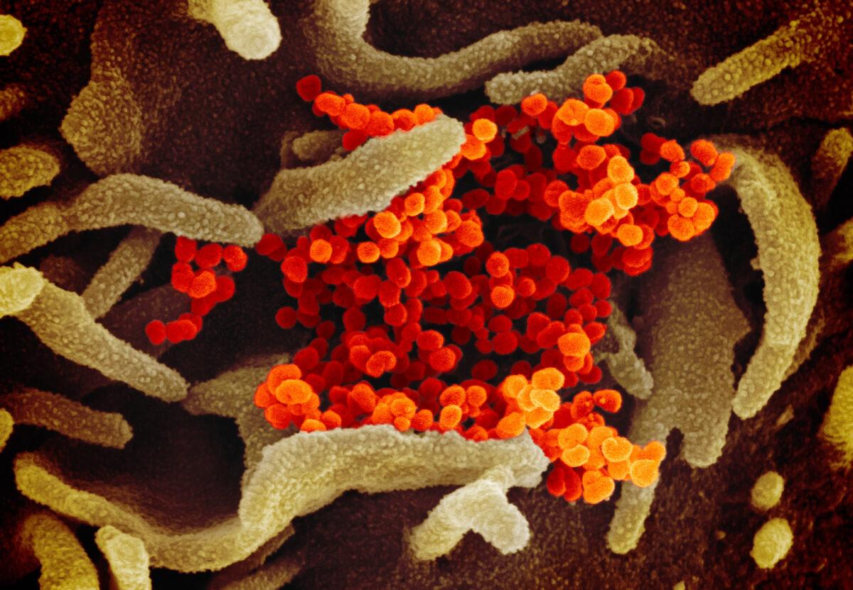This scanning electron microscope image shows the CCP virus (orange), which causes COVID-19 disease, isolated from a patient in the U.S., emerging from the surface of cells (green) cultured in the lab. Photo published on Feb. 13, 2020. (NIAID-RML)