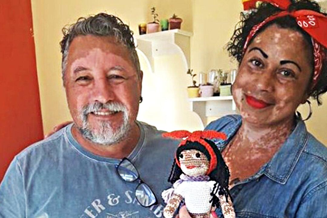 Grandpa Knits Dolls With Vitiligo for Kids Suffering From This Rare Skin Condition