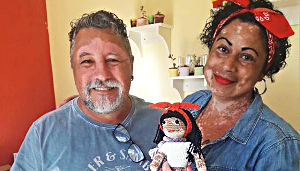 Grandpa Knits Dolls With Vitiligo for Kids Suffering From This Rare Skin Condition