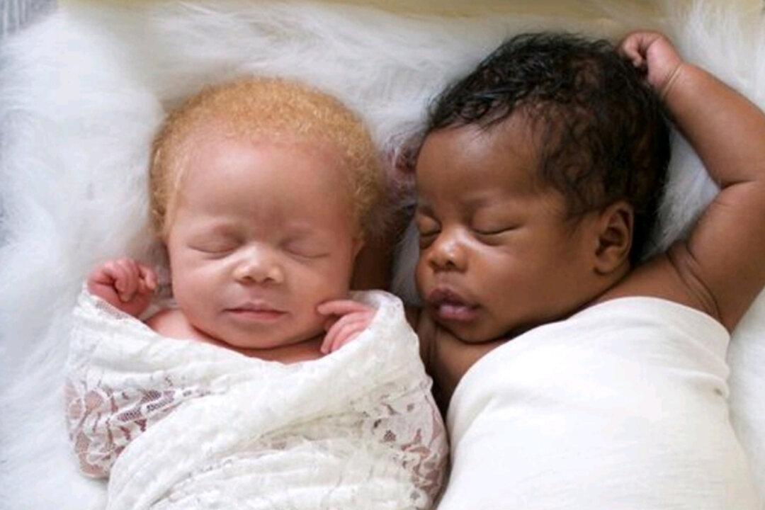 Photographer Gives Birth to Twins, One Black, the Other White, Takes Stunning Photos of Albino Daughter
