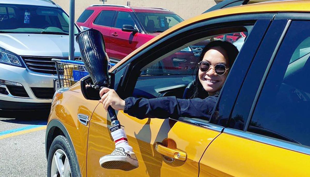 Amputee Challenges ‘Handicapped Parking Vigilantes’ After Rude Stranger’s Mistake