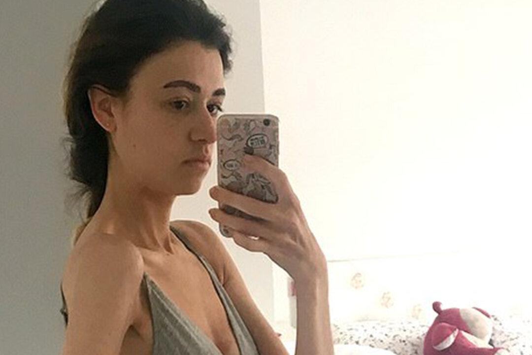 Anorexic Woman Beats Eating Disorder After Doctors Warn Her Organs Can Fail on Flight