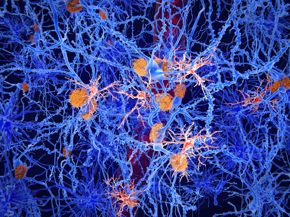 How Brain’s ‘Immune Cells’ Can Fight Meningitis, Alzheimer’s—or Backfire
