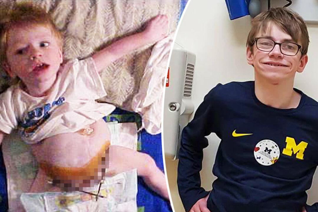 Boy Born With Organs Outside His Body Wasn’t Supposed to Survive, Celebrates High School Grad