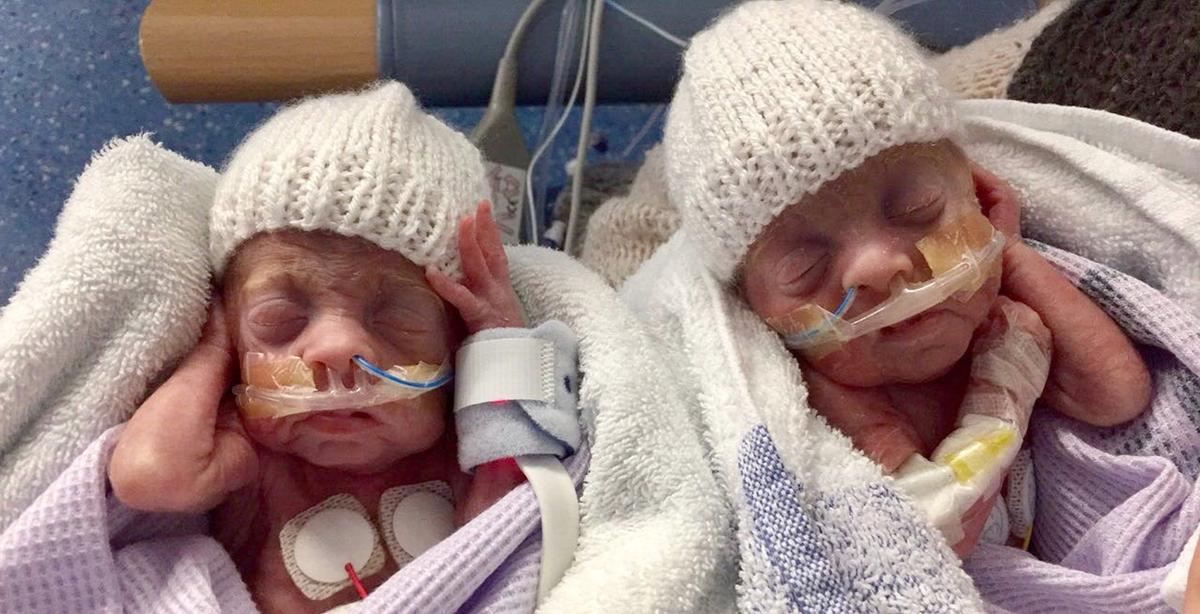 Miracle Twins Born at 24 Weeks Beat the Odds to Survive and Are Now Thriving Toddlers