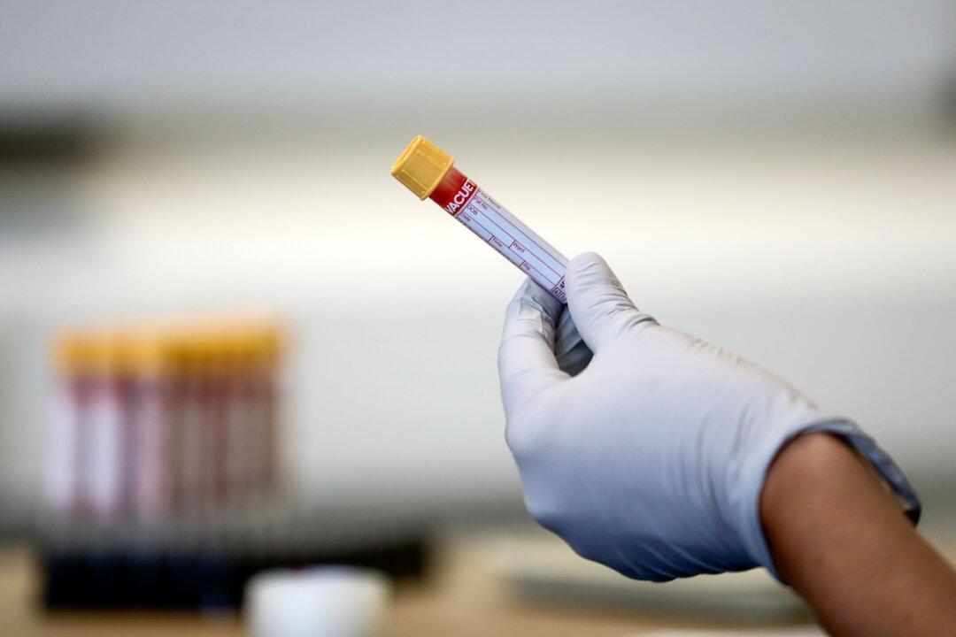 Smiths to Help Make Blood-Based Coronavirus Test in Britain