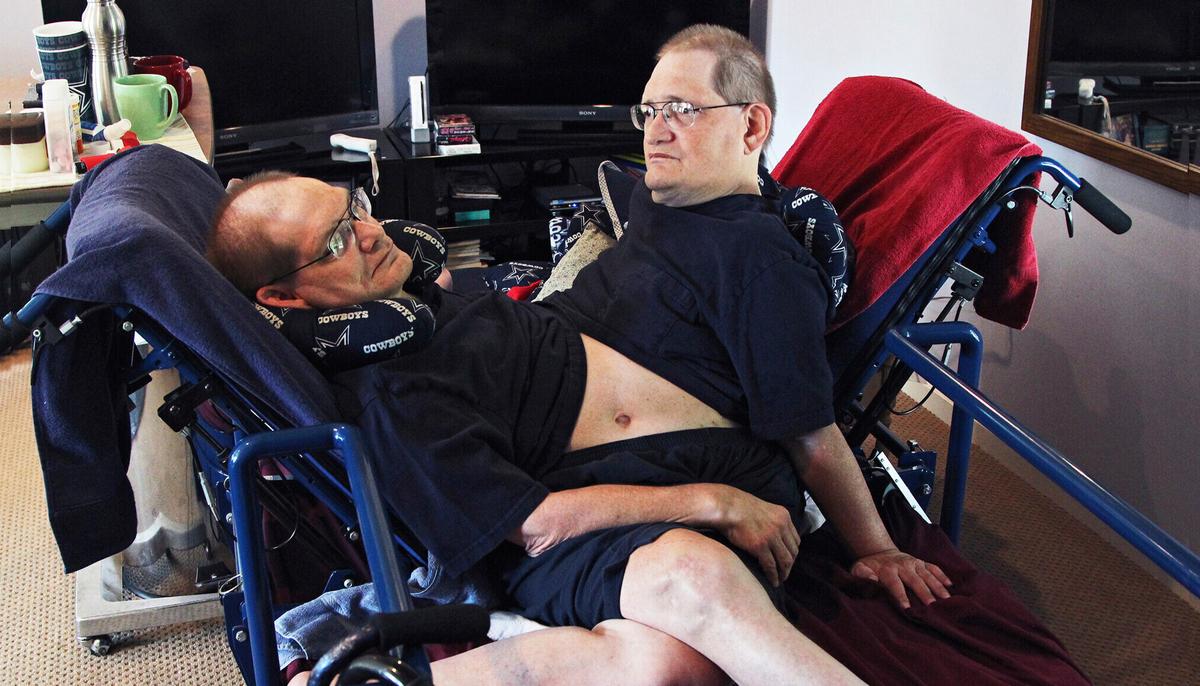 World’s Longest-Surviving Conjoined Twin Brothers Die at the Age of 68
