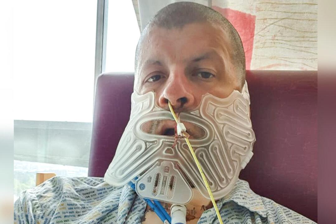 Man Who Hadn’t Been to a Dentist for 27 Years Has Jaw Removed After Fist-Sized-Tumor Diagnosis