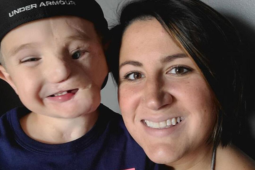 Heartbroken Mom’s 5-Year-Old Whose Face Was Ripped Off by Dogs Called ‘Monster’ by Strangers