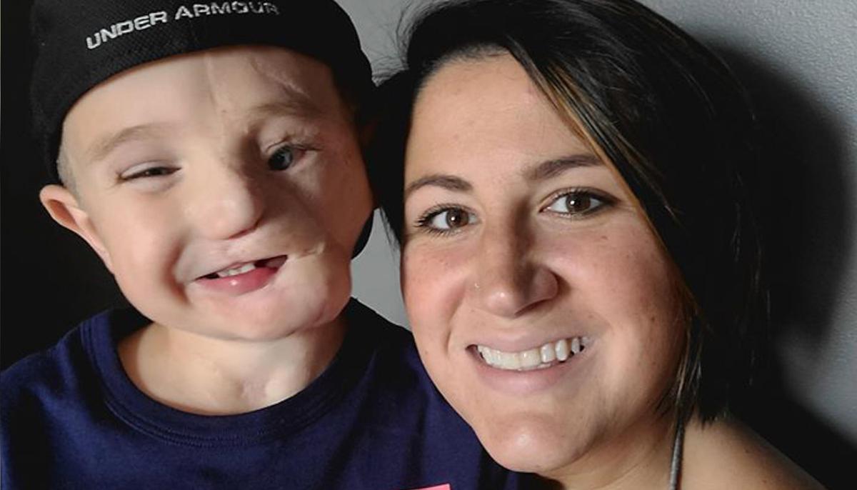 Heartbroken Mom’s 5-Year-Old Whose Face Was Ripped Off by Dogs Called ‘Monster’ by Strangers