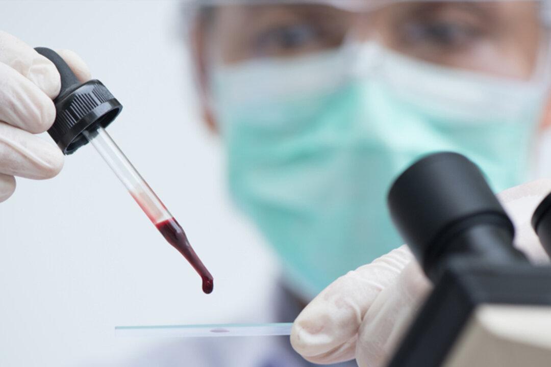 San Diego Researchers Say New Blood Test Can Detect Cancer 4 Years Before It Appears