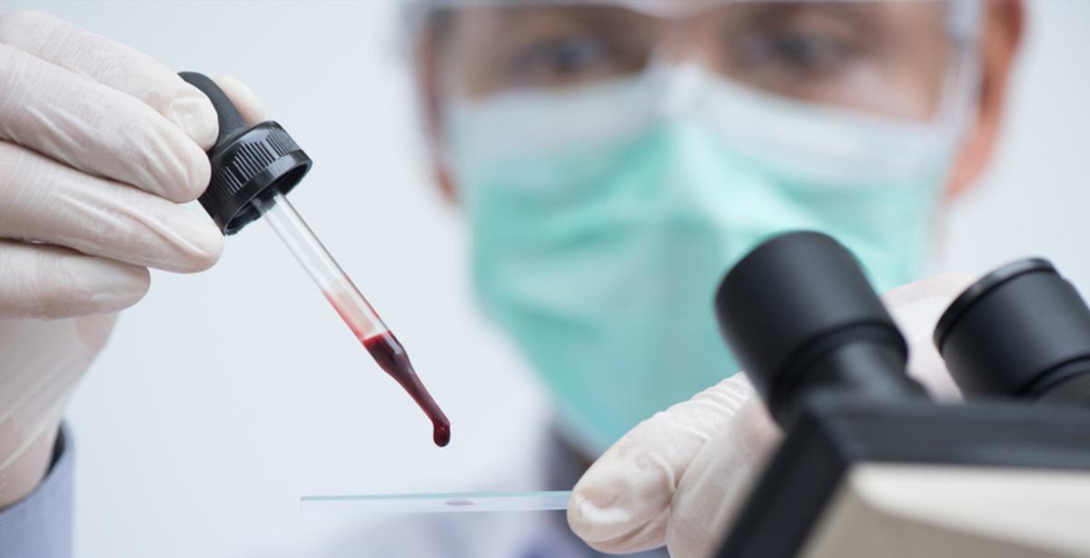 San Diego Researchers Say New Blood Test Can Detect Cancer 4 Years Before It Appears