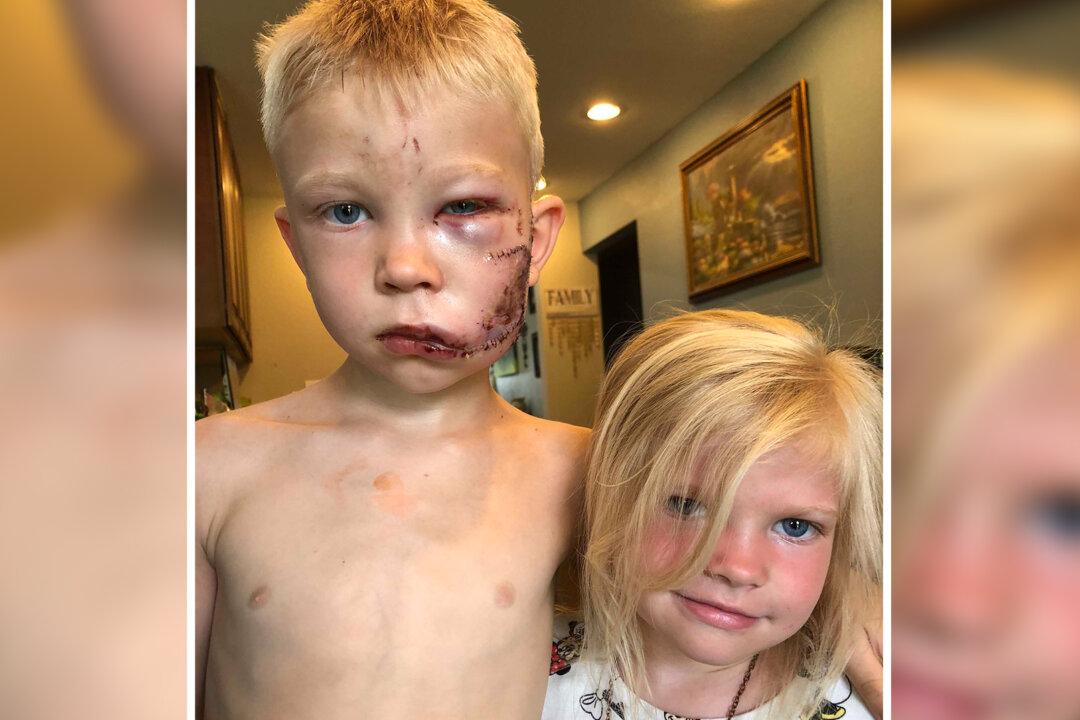 6-Year-Old Boy Mauled by Dog While Protecting Sister: ‘If Someone Had to Die, It Should Be Me’