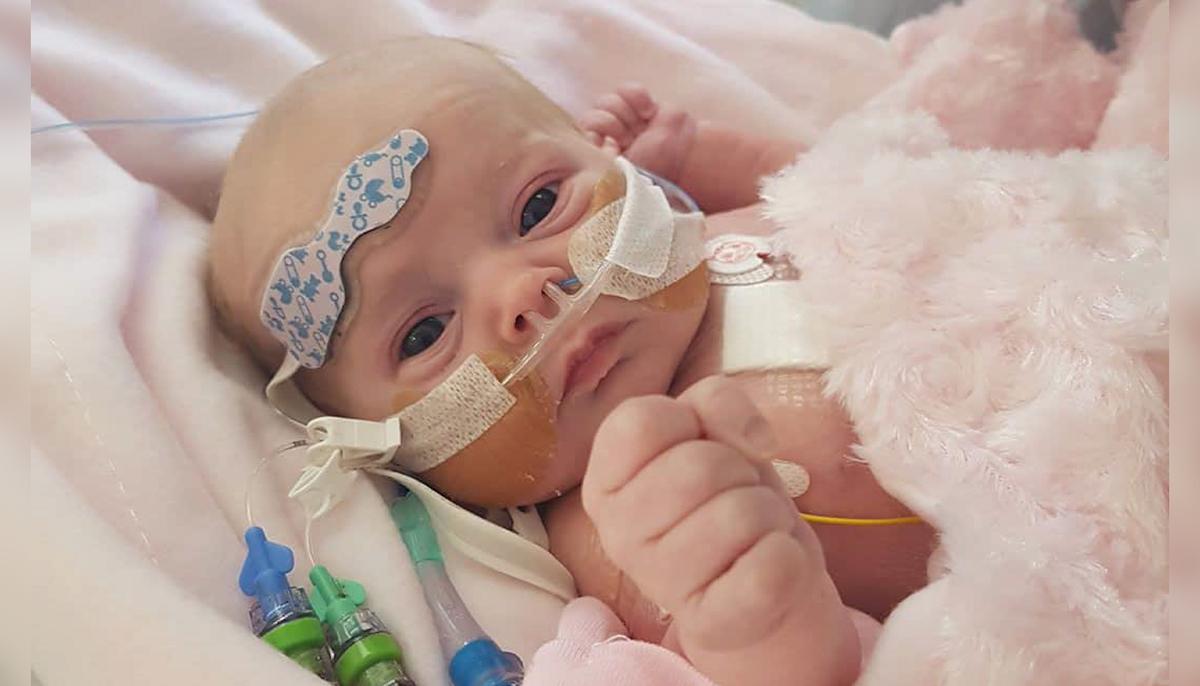 Girl Born With Rare Heart Defect Survives Two Major Surgeries, Is All Set to Turn 3 Years Old