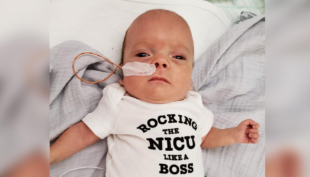 Premature Baby Born at 23 Weeks–So Tiny He Could Wear Mom’s Wedding Ring on Wrist–Is Thriving