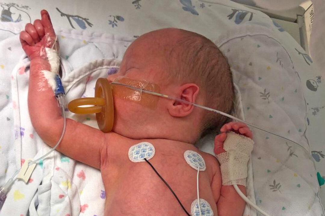 Baby Born With Small Intestines Outside His Tiny Body Has a Successful Surgery
