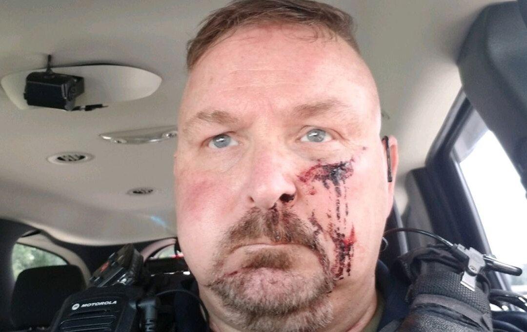South Carolina Police Chief Stabbed With Icepick After Answering Door