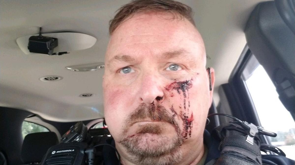 South Carolina Police Chief Stabbed With Icepick After Answering Door