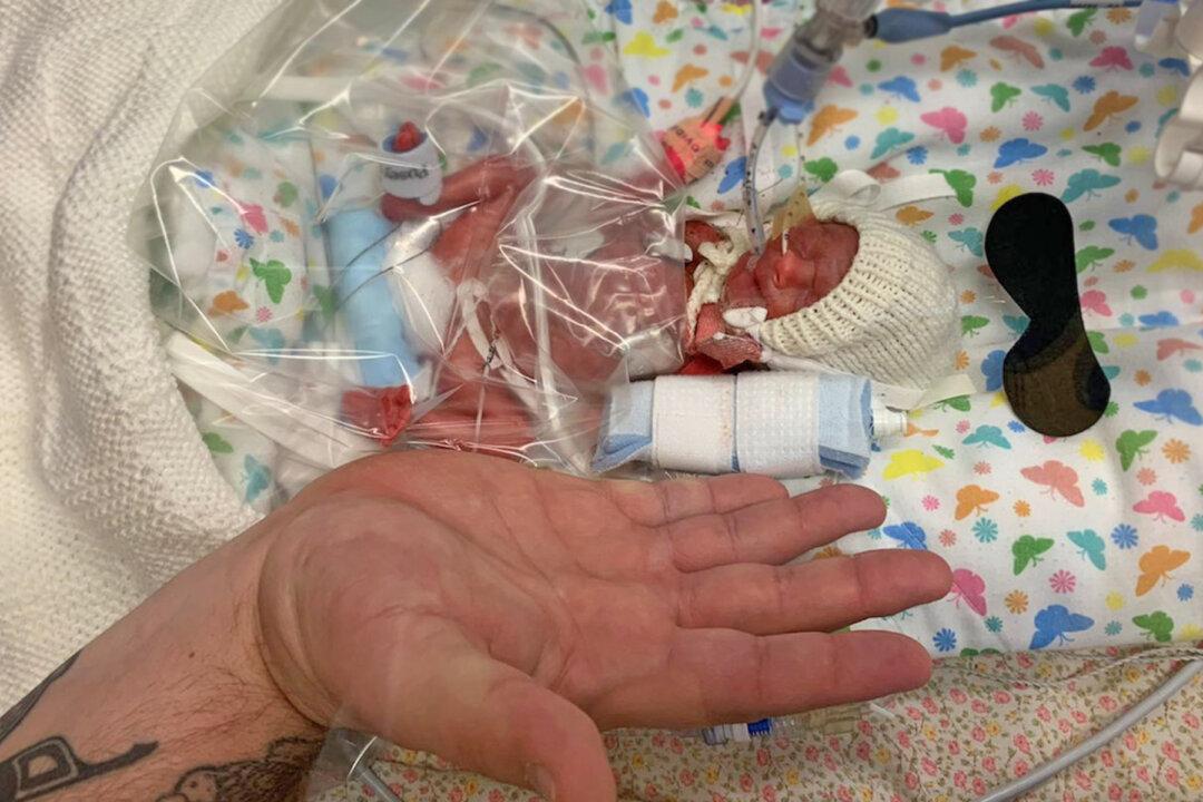 Baby Born Smaller Than Her Dad’s Hand and Given 10 Percent Chance of Survival Goes Home