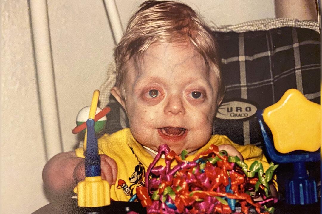 Hospice Nurse Who Cared for Boy With Rare Disorder as a Baby Takes His Senior-Year Photos