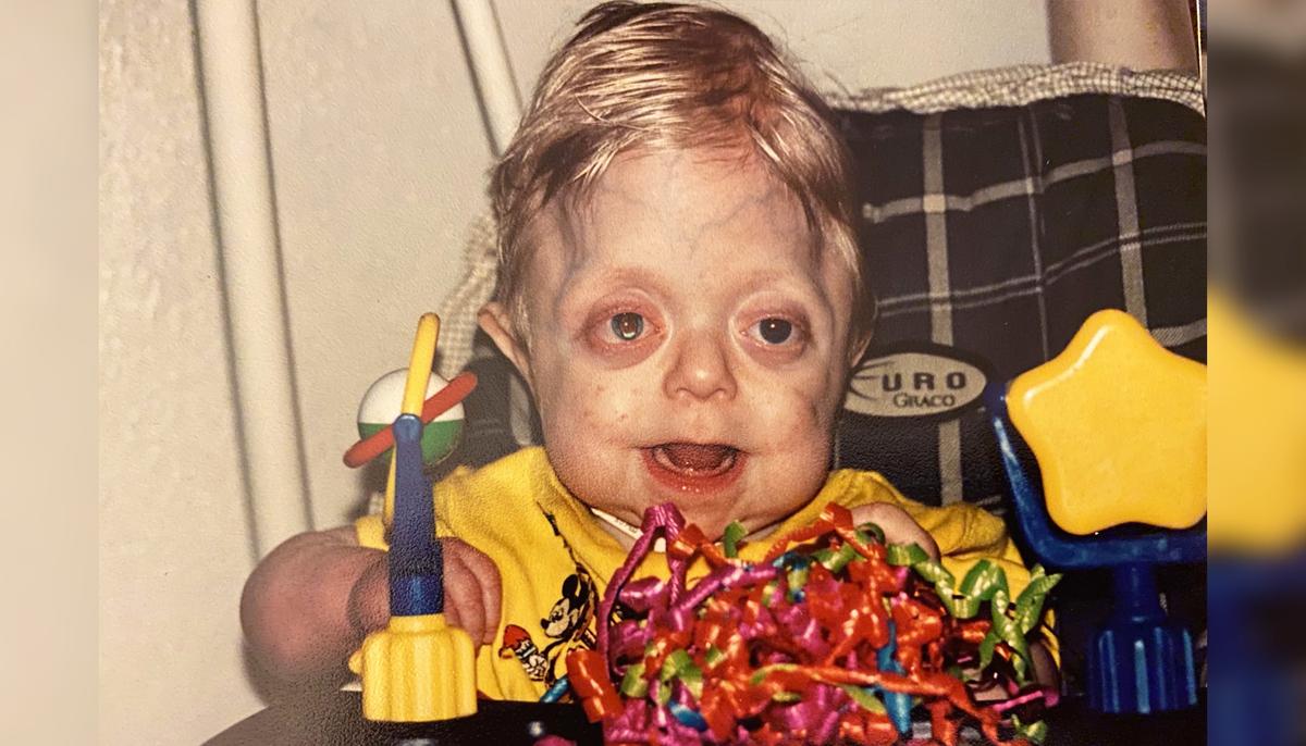 Hospice Nurse Who Cared for Boy With Rare Disorder as a Baby Takes His Senior-Year Photos