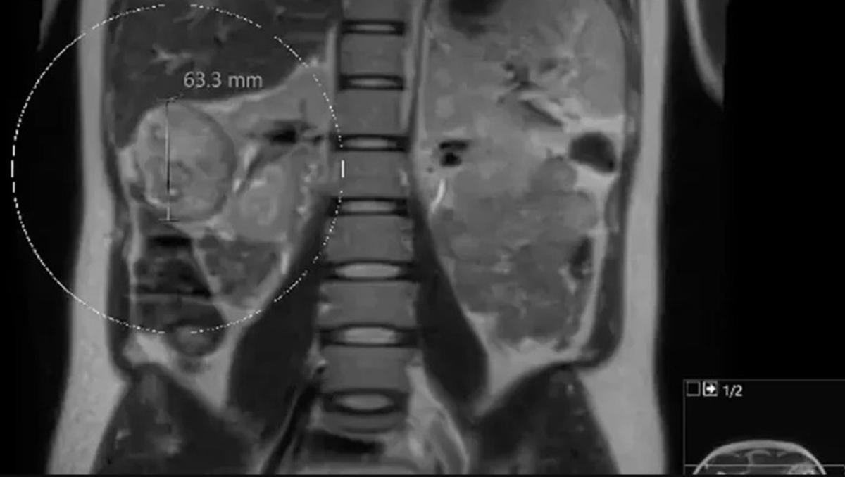 The emergency scan. (Caters News)