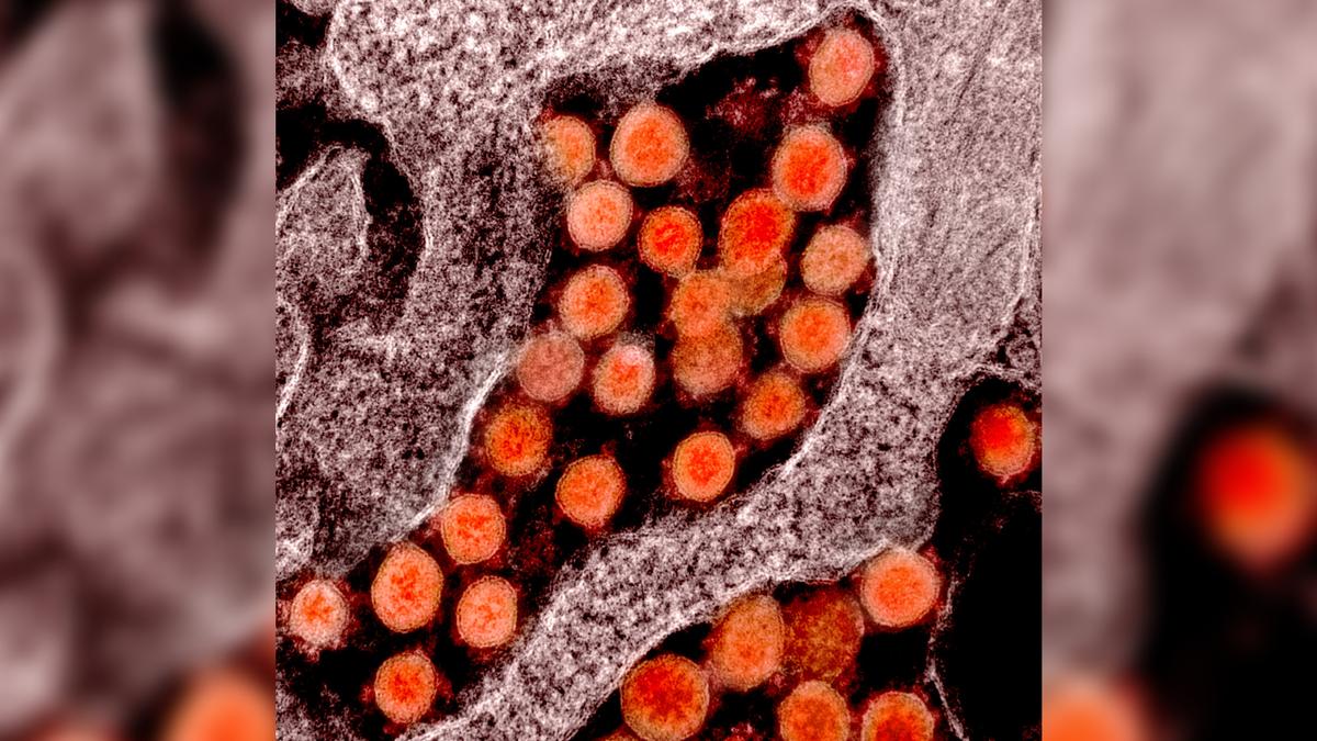CCP Virus Could Cause Permanent Deafness Warn Researchers
