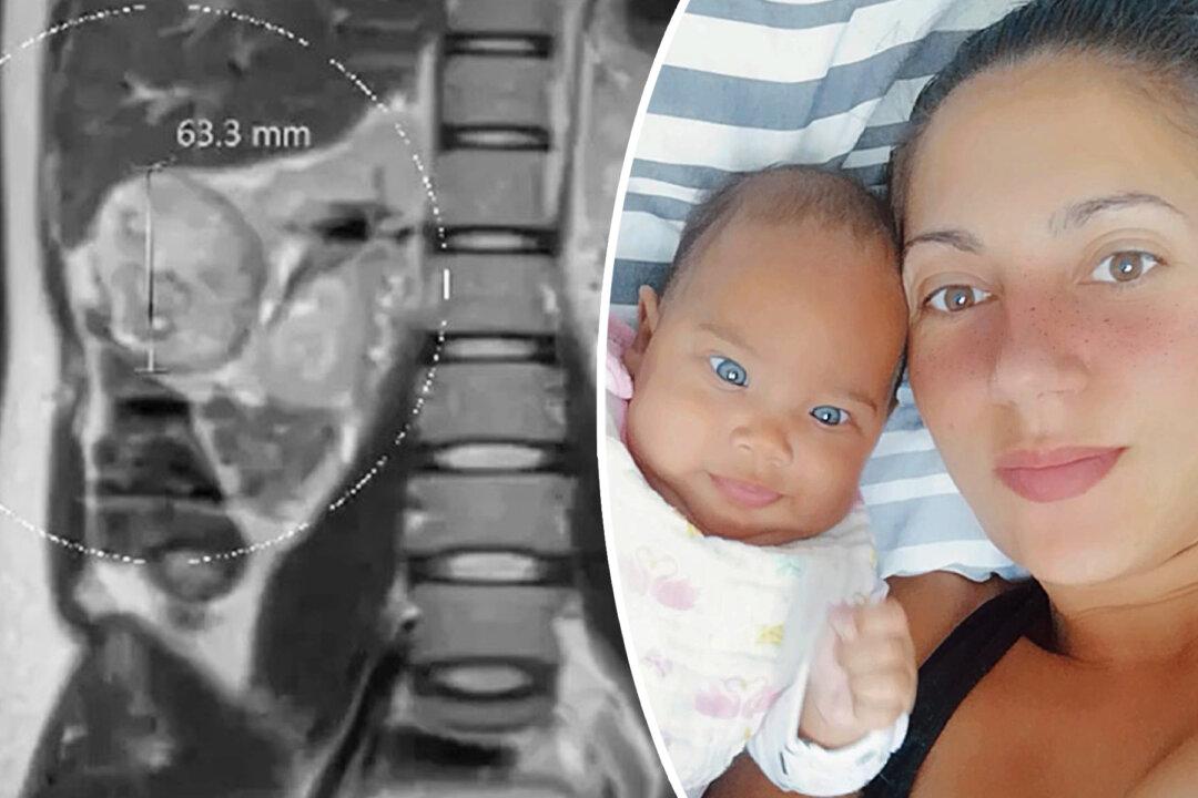 Mom Credits Baby for Saving Her Life After Doctors Spotted Grape-Sized Tumor During Pregnancy
