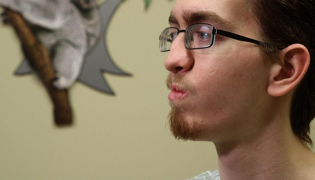 Groundbreaking Cleft Palate Surgery Changes 20-Year-Old Patient’s Life